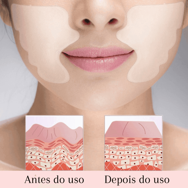 Adesivos Antirrugas FitBotox - Loja STERS.Mey