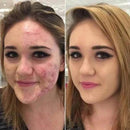 Base BB Cream Corretivo com Esponja Cogumelo – Cobertura Perfeita, Hidratação e Longa Duração - Loja STERS.Mey