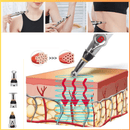 Caneta de Acupuntura Elétrica - Loja STERS.Mey