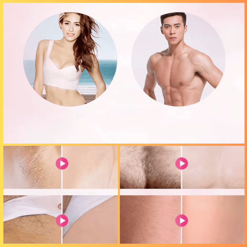 Depilador à Laser Permanente-IPL - Loja STERS.Mey