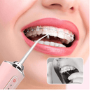 Irrigador Oral Portátil – Limpeza Profunda e Hálito Fresco em Poucos Minutos - Loja STERS.Mey