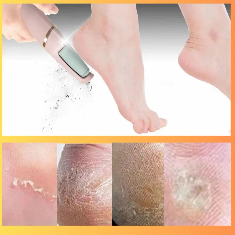 Lixa Elétrica para Pés – Esfoliação Profunda e Pés Macios em Minutos - Loja STERS.Mey