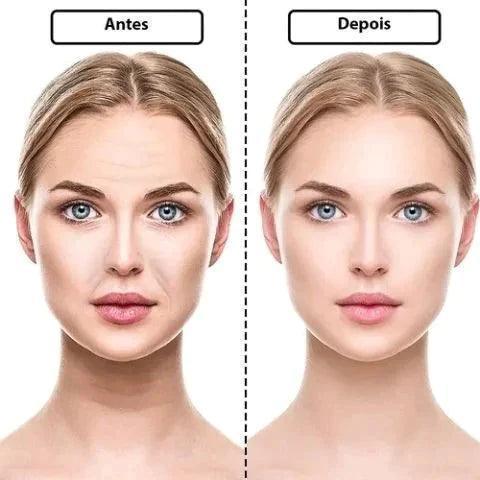 Adesivos Antirrugas FitBotox - Loja STERS.Mey