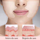 Adesivos Antirrugas FitBotox - Loja STERS.Mey