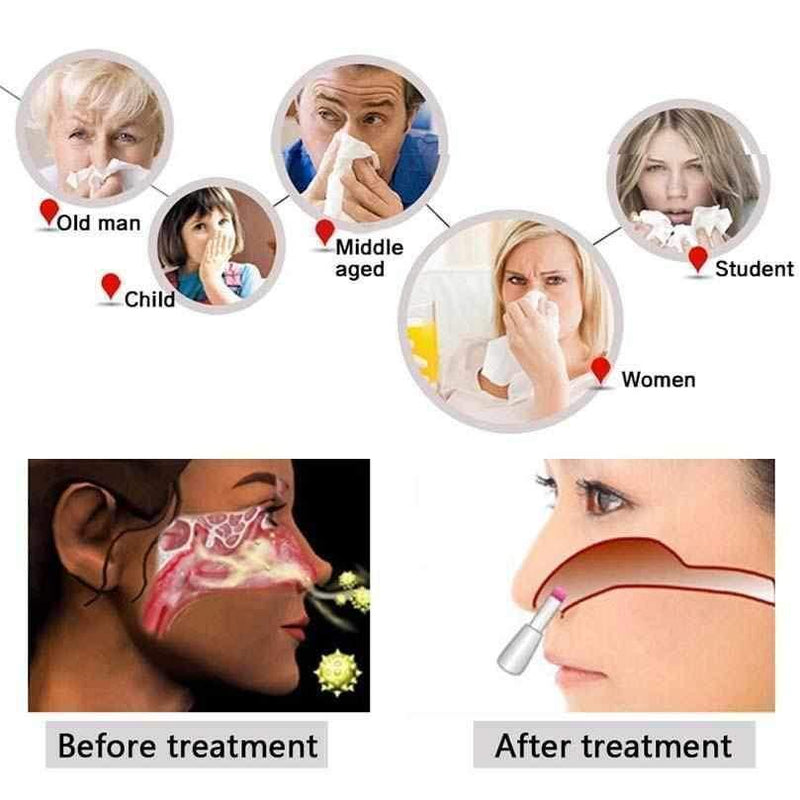 Aparelho para Tratamento de Rinite e Sinusite - Rinite Therapy - Loja STERS.Mey