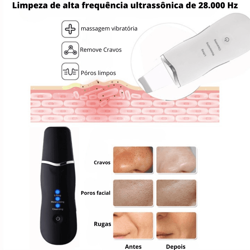 Espátula Peeling Ultrassônico-Para Cravos - Loja STERS.Mey