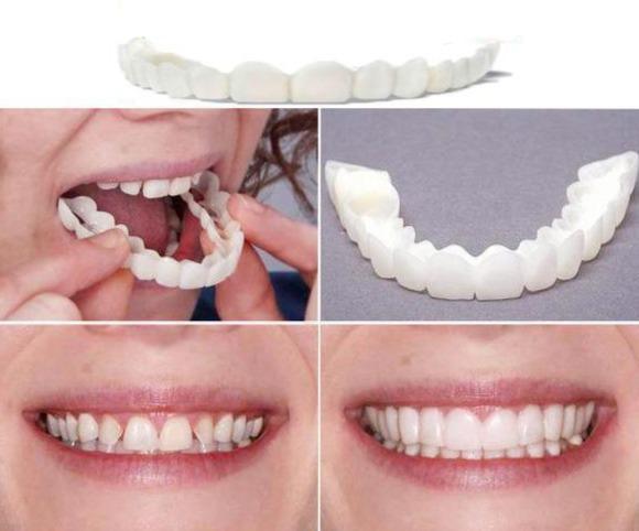 facetas-odontologicas-removiveis-smileveneers-loja-sters-mey-7 - Loja STÉRS.Mey