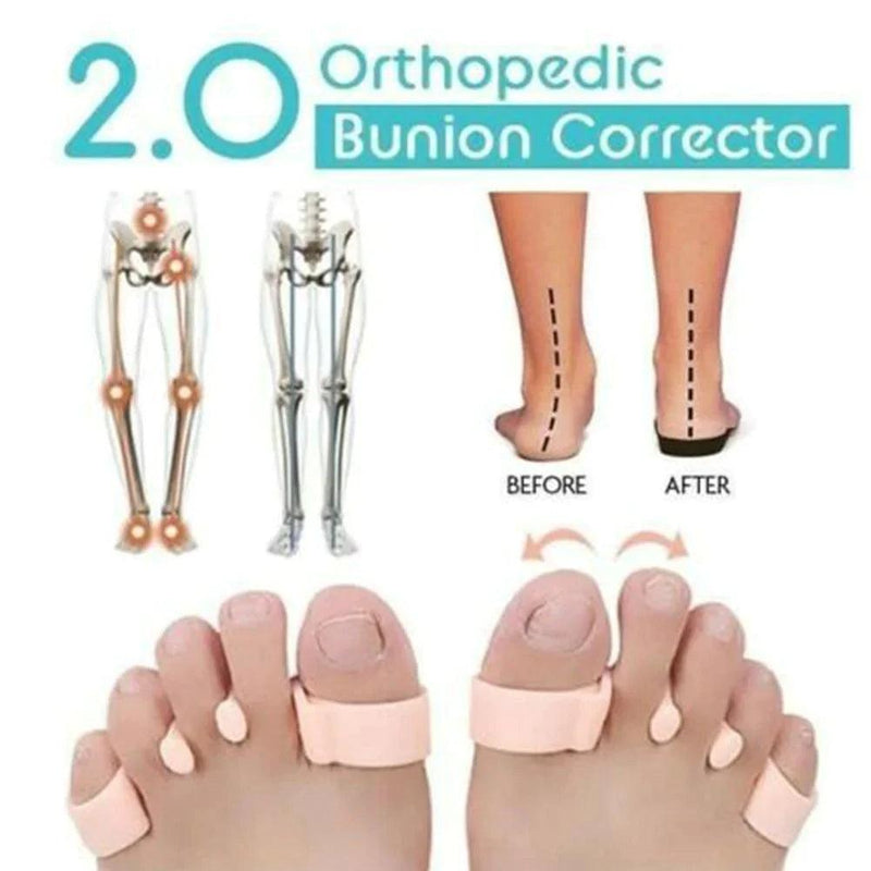 Separador de Dedos Ortopédico - Loja STERS.Mey